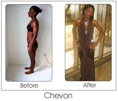 Chevon